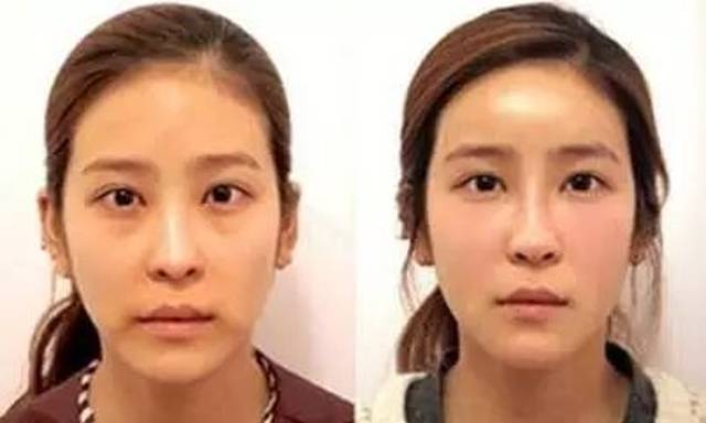 却还是有一种年代感 太阳穴凹陷,颧骨会显得很高 还给人一种头小脸大