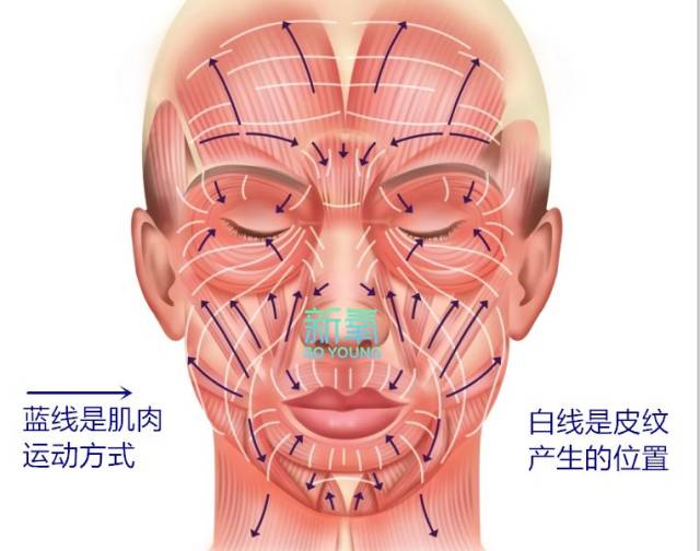 随之而来的就是颧脂垫下垂引发法令纹,颊脂垫松弛出现木偶纹,嘴角囊袋