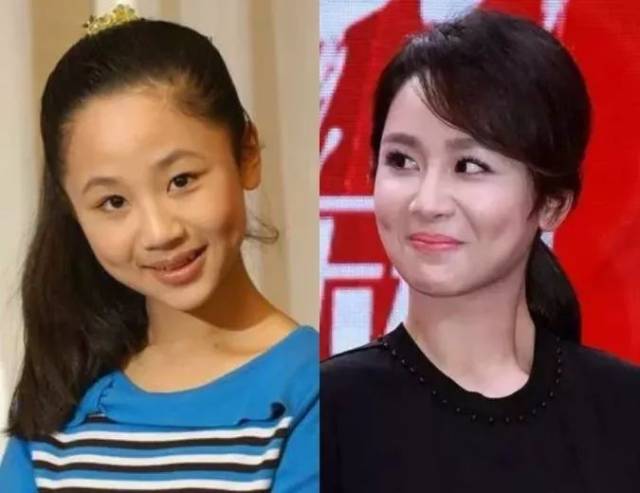 比如杨紫小姐姐就曾经发微博 呼吁大家救救天生就有法令纹的孩子 仔细