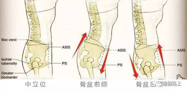 一,骨盆 骨盆容易前后倾斜和左右高低不平.