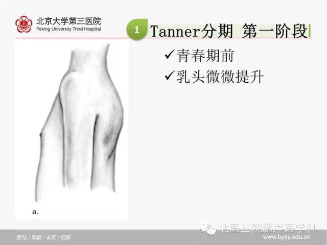 【超声微课堂】乳腺发育,分期及超声表现