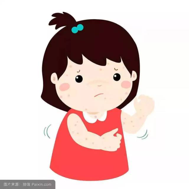 【保健】团结四小秋冬季预防水痘常识