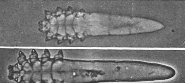 上面人蠕形螨,下面是皮脂蠕形螨