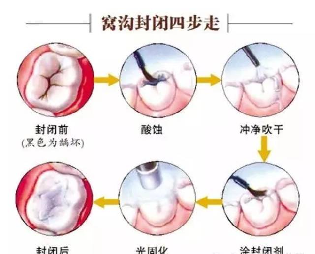 【博苑·口腔保健篇】关注口腔健康,从牙齿开始!