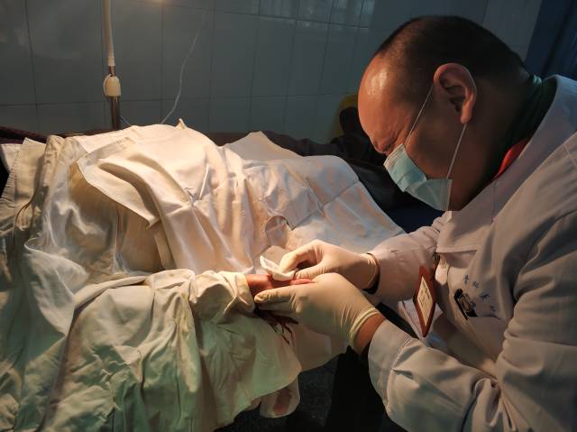 邢宝主任为患者进行狭窄性腱鞘炎手术