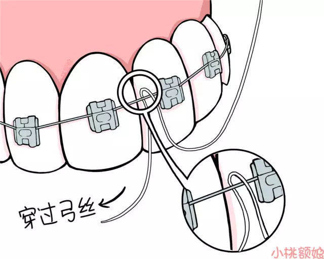 再按照牙线常规使用方法 清理牙缝间的食物残渣