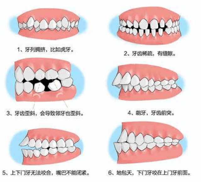 陈永安告诉你牙齿矫正的最佳年龄是什么时候