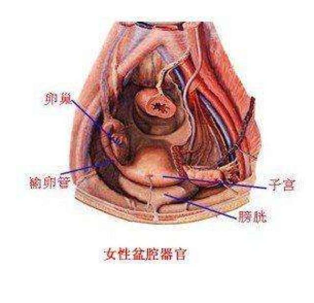 检查发现"盆腔积液"该怎么办?