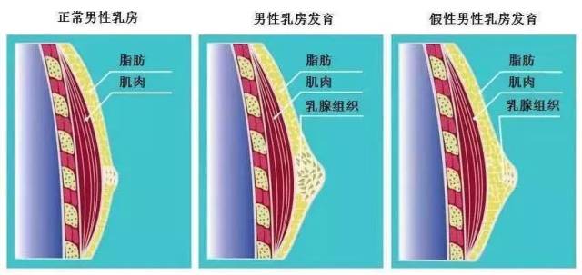 大三男生的乳房越来越大,居然是因为用了女朋友的这样东西……