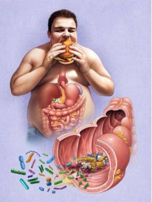 发现:肥胖组的肠道菌群无论是基因数量和丰富度都低于正常体重人群.