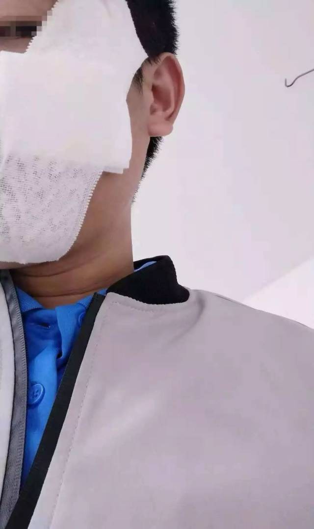 厦门一高楼BT页游,砸中路人!半张脸毁容,他要起诉整栋楼!