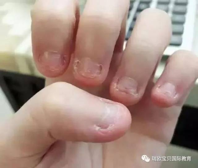 啃指甲,吃手,咬铅笔……孩子小动作背后暗藏心理