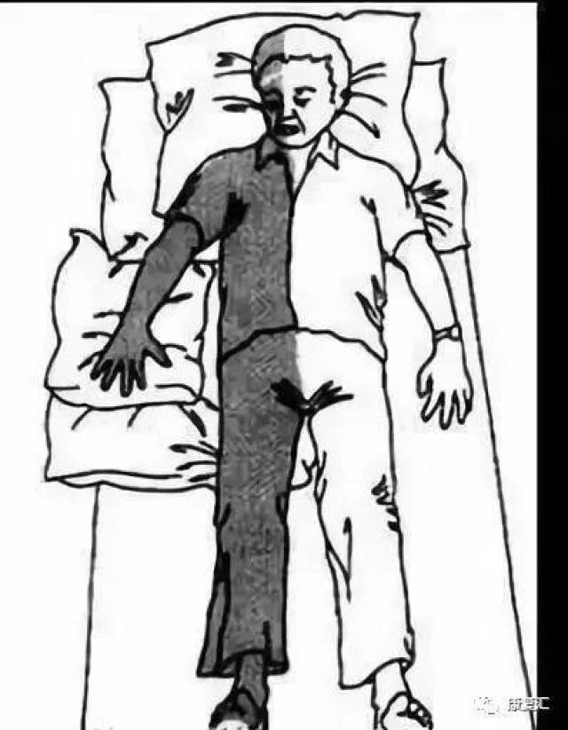 漫画图解脑卒中患者肢体的康复训练在家也能轻松康复