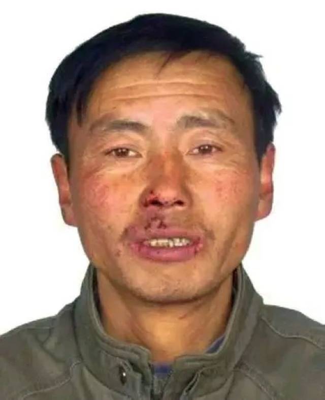 丁学广,男,回族,身份证号:642225196605030015,住宁夏泾源县丽景园
