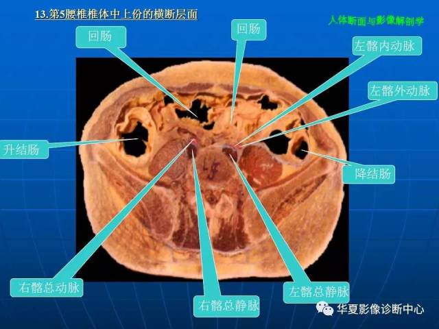 腹部断层影像解剖