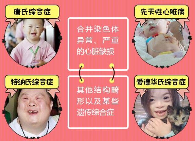 新余安瑞尔妇产医院妇产专家表示,nt检查是实现优生优育必要的检查.