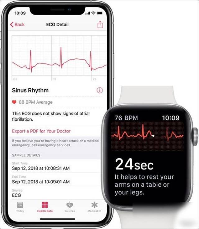 applewatch4心电图功能 早前苹果方面曾强调,applewatchseries4的ecg