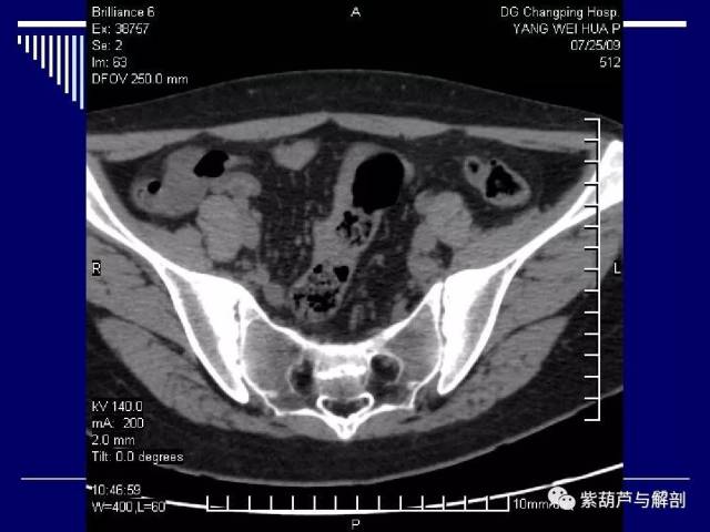 骶髂关节的解剖病理特点及中西医诊治