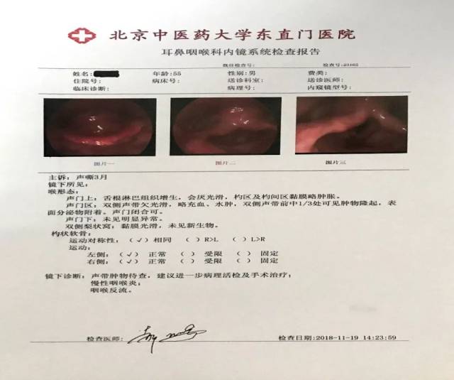 耳鼻喉科完成局麻下脑梗合并强直性脊柱炎患者困难气道下喉肿物活检术
