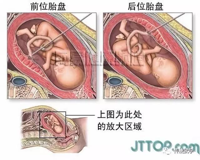 高清人体三维解剖图--白骨观,不净观可以参考观照