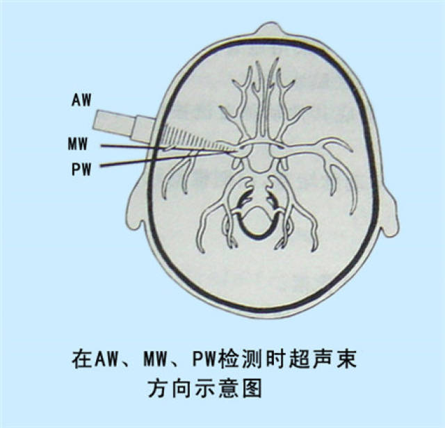 1)颞窗:超声束经颞骨鳞部进入颅内的通道.