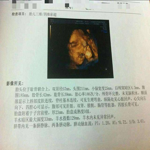 医生说30周b超只看生长情况不看内脏,很担心怎么办?准
