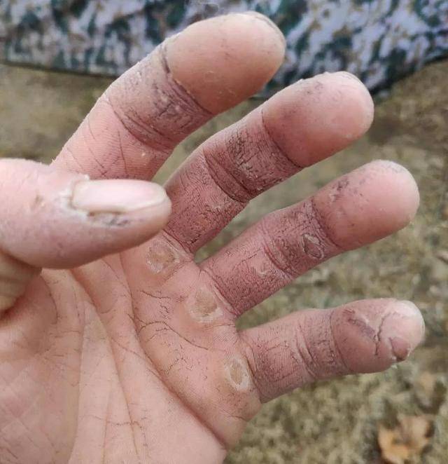不仅如此,训练也在战士们的身上留下了军人特有的"印 "".