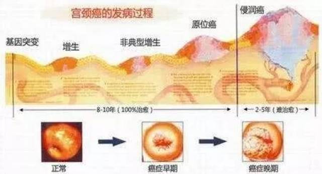 有些医院出具的是宫颈原位癌的原因)