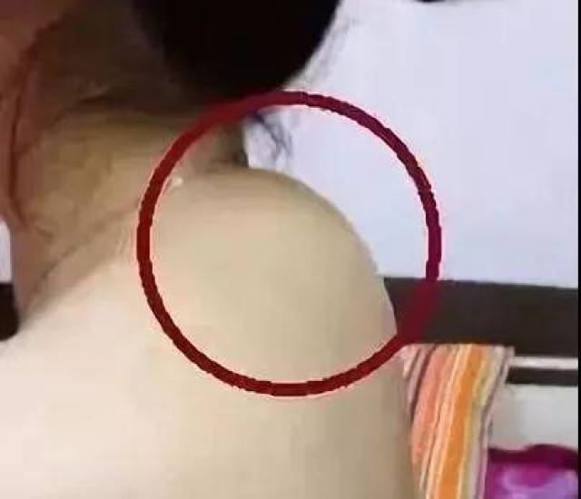 脖子后面有个