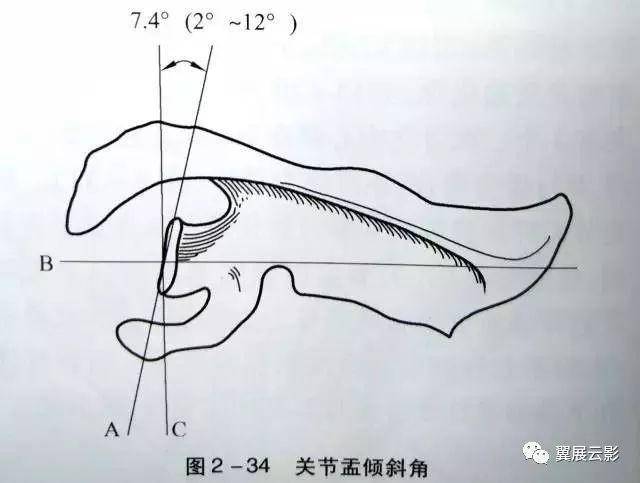 影像必备:肩关节x线解剖与重要测量数据_手机搜狐网