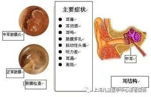 4.鼻窦炎:流浓涕,伴随头痛,注意力不集中.