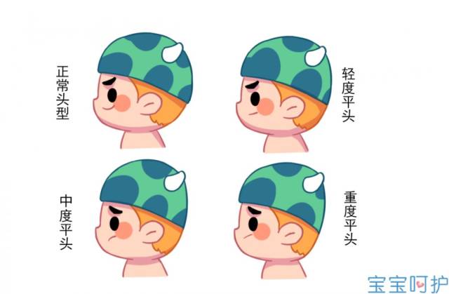 虽说体位性因素导致的扁头不会影响宝宝的智力发育,但却很影响颜值.