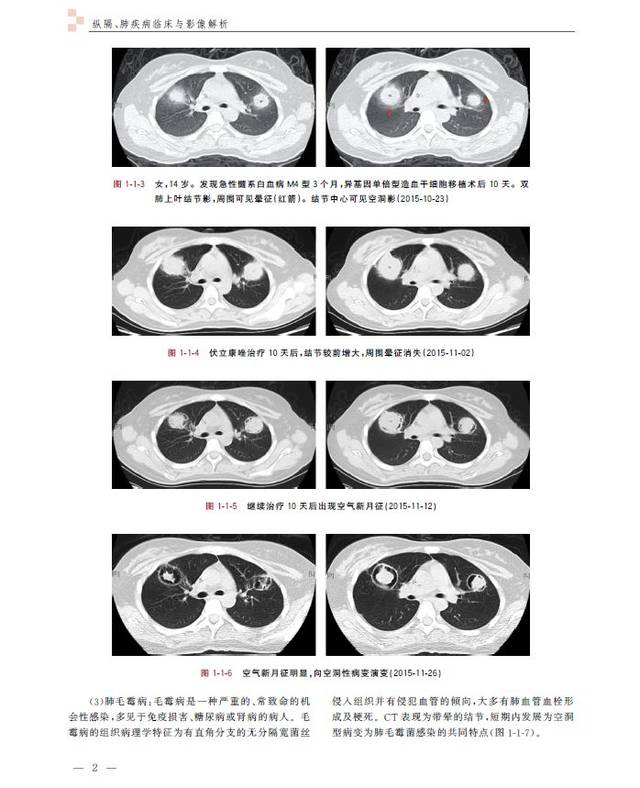 纵隔,肺疾病临床与影像解析