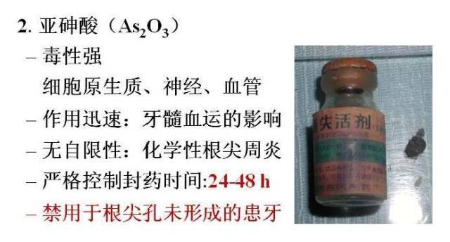 盘点牙髓失活剂的常用种类,用法及注意事项