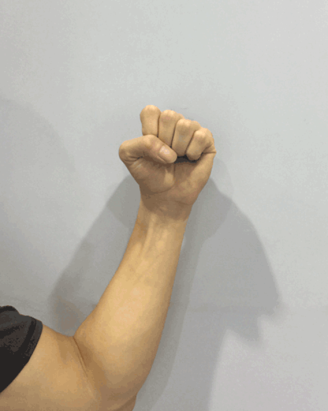 1,保守治疗: 进入腕管综合症急性期, 当感到疼痛肿胀及灼烧感时应