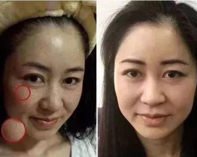 为什么说女人脸上长斑,就要小心妇科疾病呢?