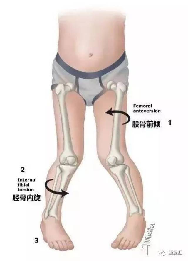 八个动作有效康复改善x型腿,坚持才有效!