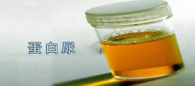 出现原因某些疾病,如糖尿病或高血压,可能会导致肾小球受损.
