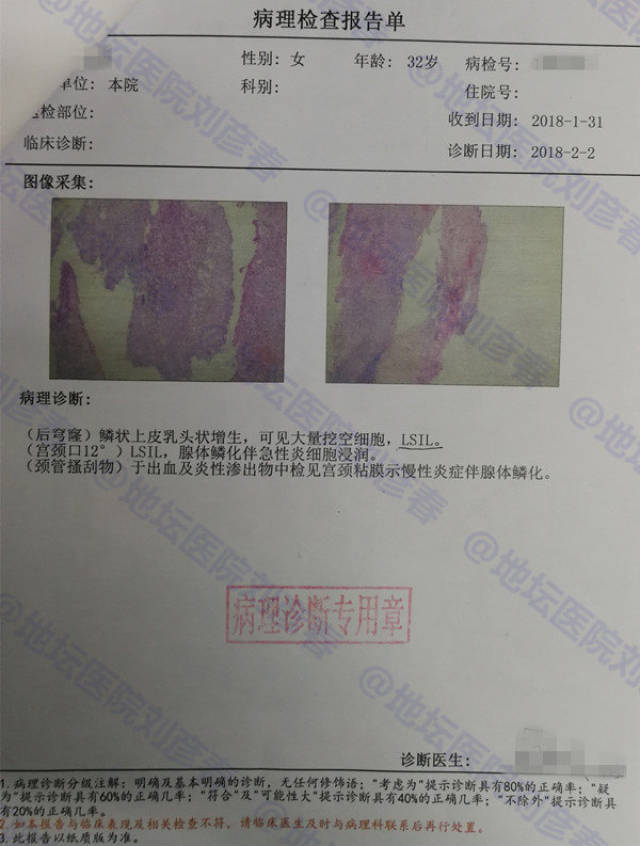 检查出cin3可以买保险吗 宫颈锥切后转癌几率