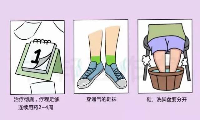 一,避免光脚穿鞋,尽量穿棉袜