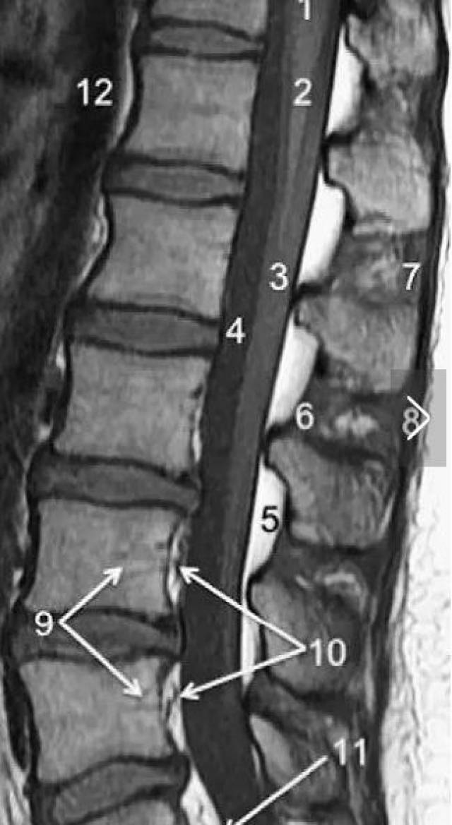 胸,腰椎mri解剖图谱,请收好
