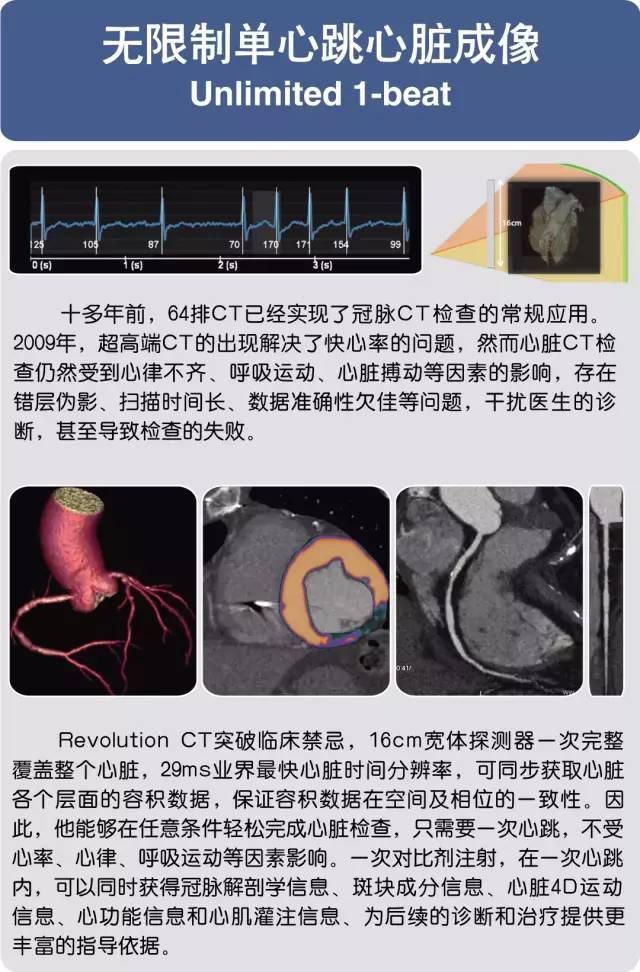 全球顶级ge 256排revolution ct落户大理州医院