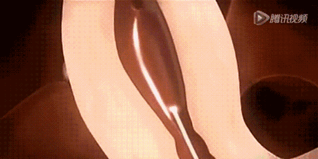 一一击碎试管移植后的这些