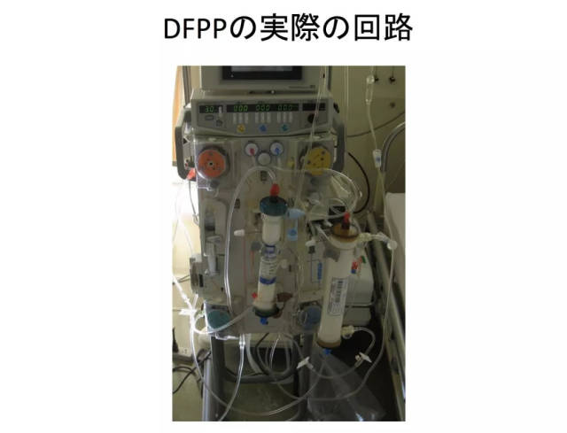 日本高端dfpp疗法:血液也需要净化!