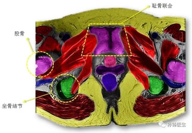 医学笔记|锋哥教你读盆腔核磁共振(4):经女性耻骨联合