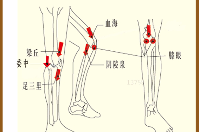 滑膜炎,半月板痛的