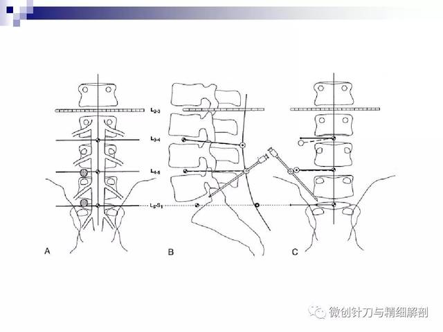 腰椎缩写 搜狐网