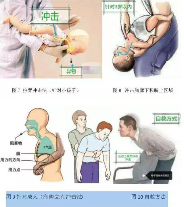 附海姆立克急救法图示