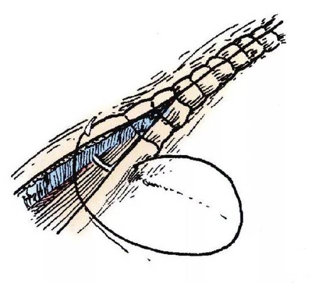 宠医常用的 13种外科缝合方法