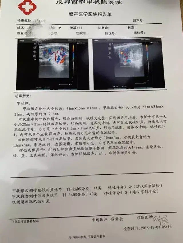 甲状腺结节超声报告分三部分, 这么看简单易懂!